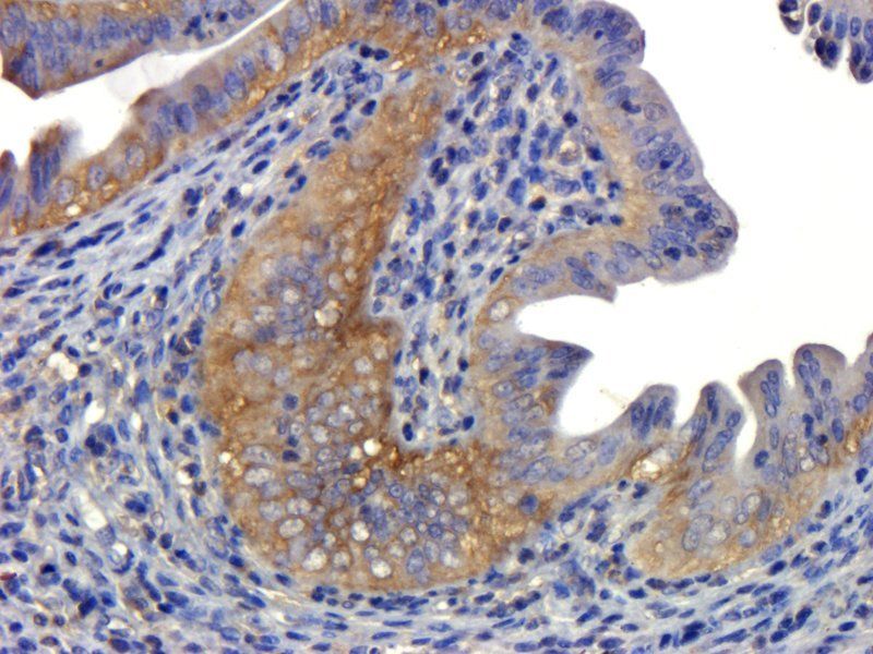 NOX1 Rabbit Polyclonal Antibody
