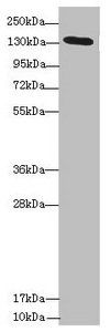 NPHP3 Antibody