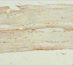 NPHP3 Antibody