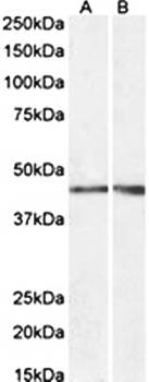 NPHS2/SRN1 Antibody