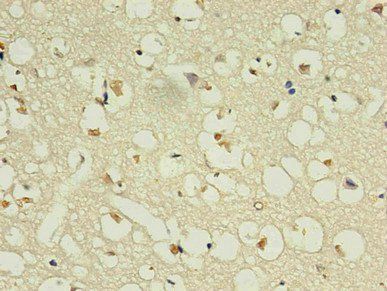 NPPB Antibody