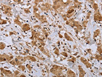 NPR2 Antibody