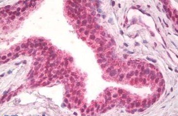 NPR3 (aa520-533) Antibody