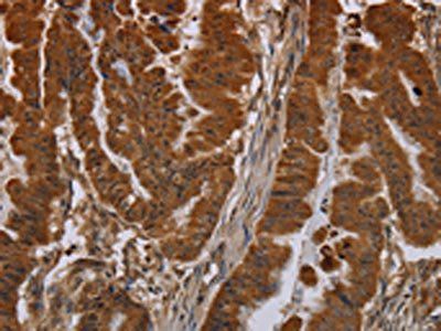 NPRL2 Antibody