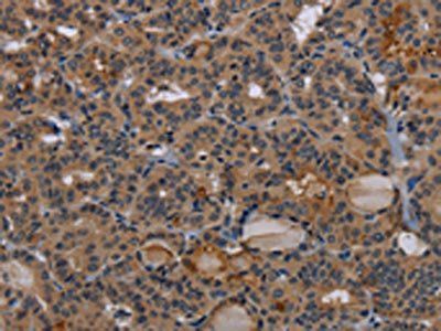 NPRL2 Antibody