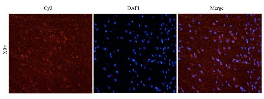 NPY1R antibody