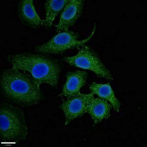 NQO1 Antibody