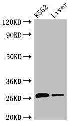 NQO2 Antibody