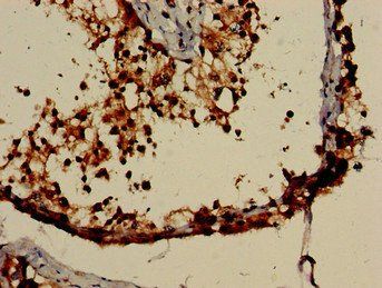 NR0B1 Antibody
