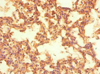 NR2C1 Antibody