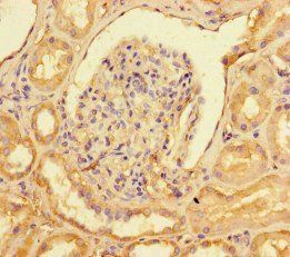 NR2F2 Antibody