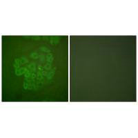 NR3C1 Antibody