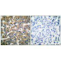 NR3C1 Antibody