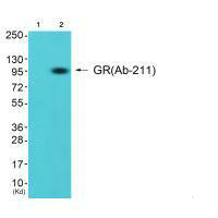 NR3C1 Antibody