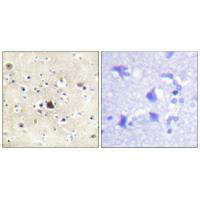 NR3C1 Antibody