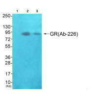 NR3C1 Antibody