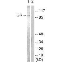 NR3C1 Antibody