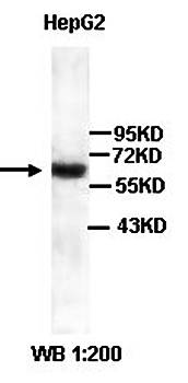 NUR77 Rabbit Polyclonal Antibody