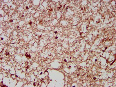 NRCAM Antibody