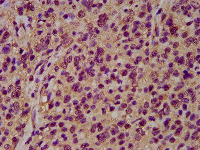 NRCAM Antibody