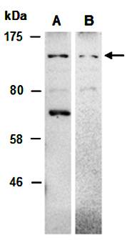 NRIP1 (N) Antibody, Rabbit Polyclonal