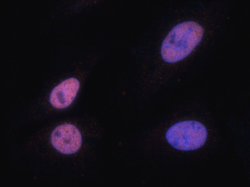 NRSF/REST antibody