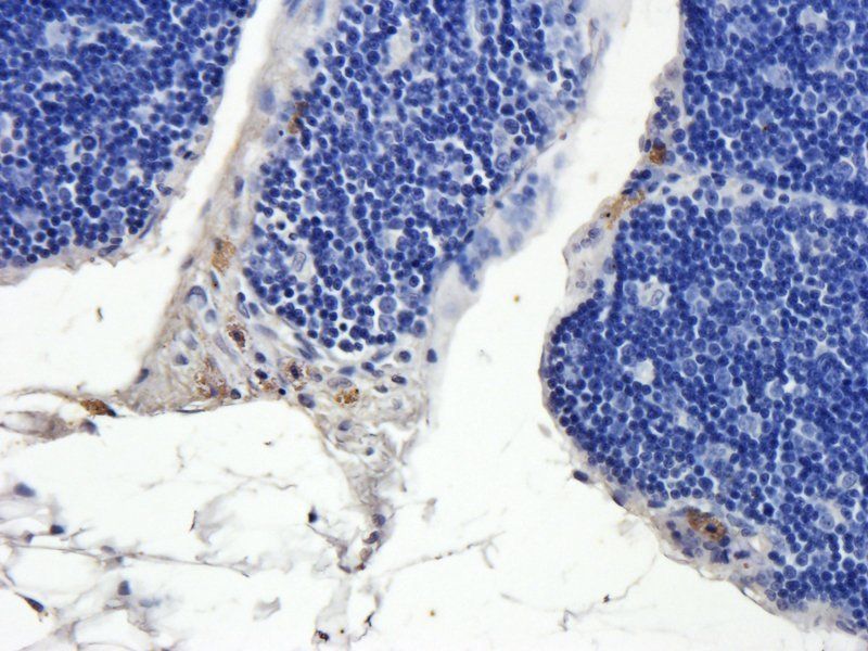 NRSF/REST antibody