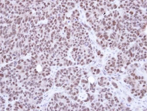 NSMCE1 Rabbit Polyclonal Antibody