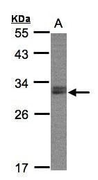 NSMCE1 Rabbit Polyclonal Antibody