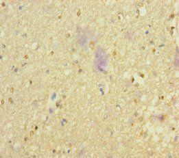NSMF Antibody