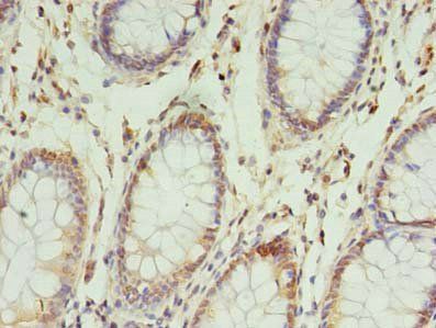 NSUN4 Antibody
