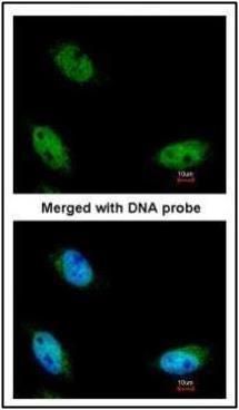 NSUN6 Rabbit Polyclonal Antibody