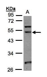 NSUN6 Rabbit Polyclonal Antibody
