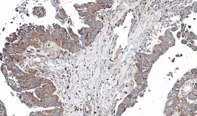 NT5C2 Rabbit Polyclonal Antibody