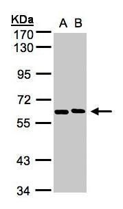 NT5C2 Rabbit Polyclonal Antibody