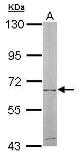 NT5C2 Rabbit Polyclonal Antibody