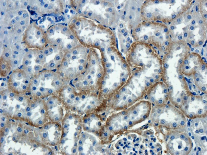 NTCP antibody