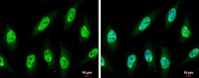 Nucleoporin p62 Rabbit Polyclonal Antibody