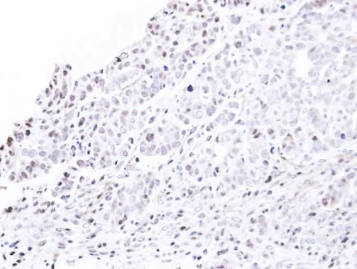 Nucleoporin p62 Rabbit Polyclonal Antibody