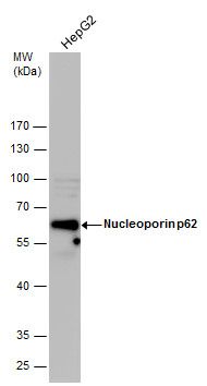 Nucleoporin p62 Rabbit Polyclonal Antibody