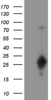 NDEL1 Antibody