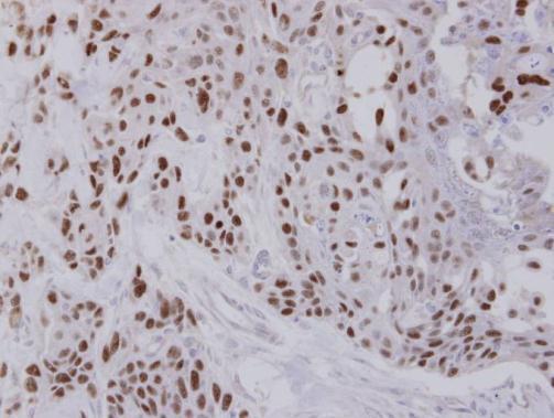 NULP1 Rabbit Polyclonal Antibody