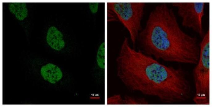 NuMA Rabbit Polyclonal Antibody