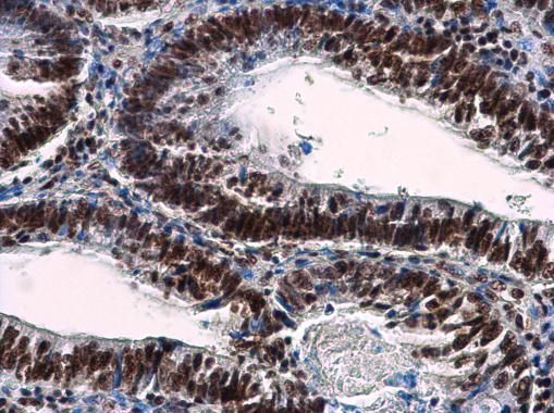 NuMA Rabbit Polyclonal Antibody