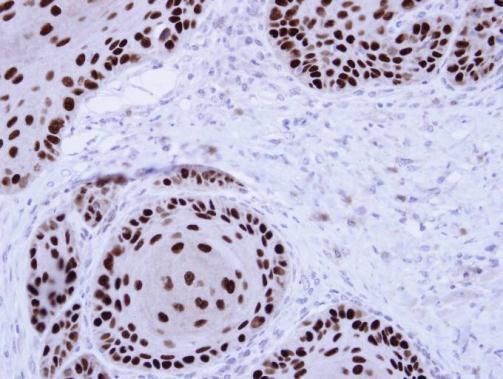 NuMA Rabbit Polyclonal Antibody