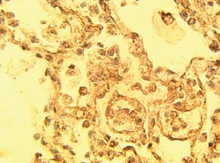 Rabbit anti Human NUMB Antibody