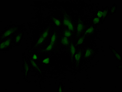 NUP98 Antibody