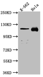NUP98 Antibody