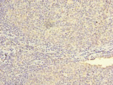 NXNL2 Antibody