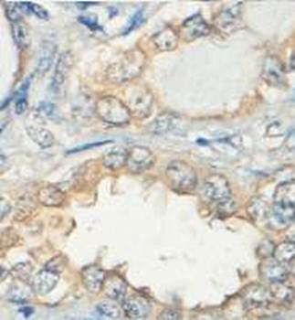 OAT Rabbit Polyclonal Antibody